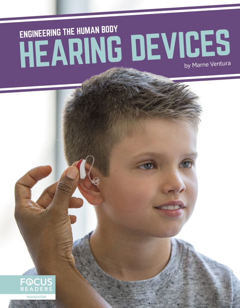 Introduces readers to the science behind hearing devices, including how and why the technology was created, current examples of the technology in action, and cutting-edge research advancing the technology. Eye-catching infographics, clear text, informative sidebars, and a “How It Works” special feature make this book an engaging introduction to this exciting technology. Preview this book.