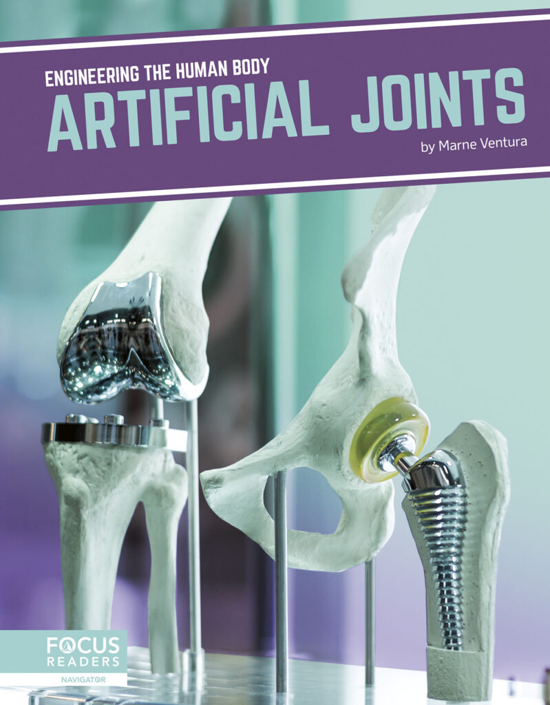 Introduces readers to the science behind artificial joints, including how and why the technology was created, current examples of the technology in action, and cutting-edge research advancing the technology. Eye-catching infographics, clear text, informative sidebars, and a “How It Works” special feature make this book an engaging introduction to this exciting technology. Preview this book.