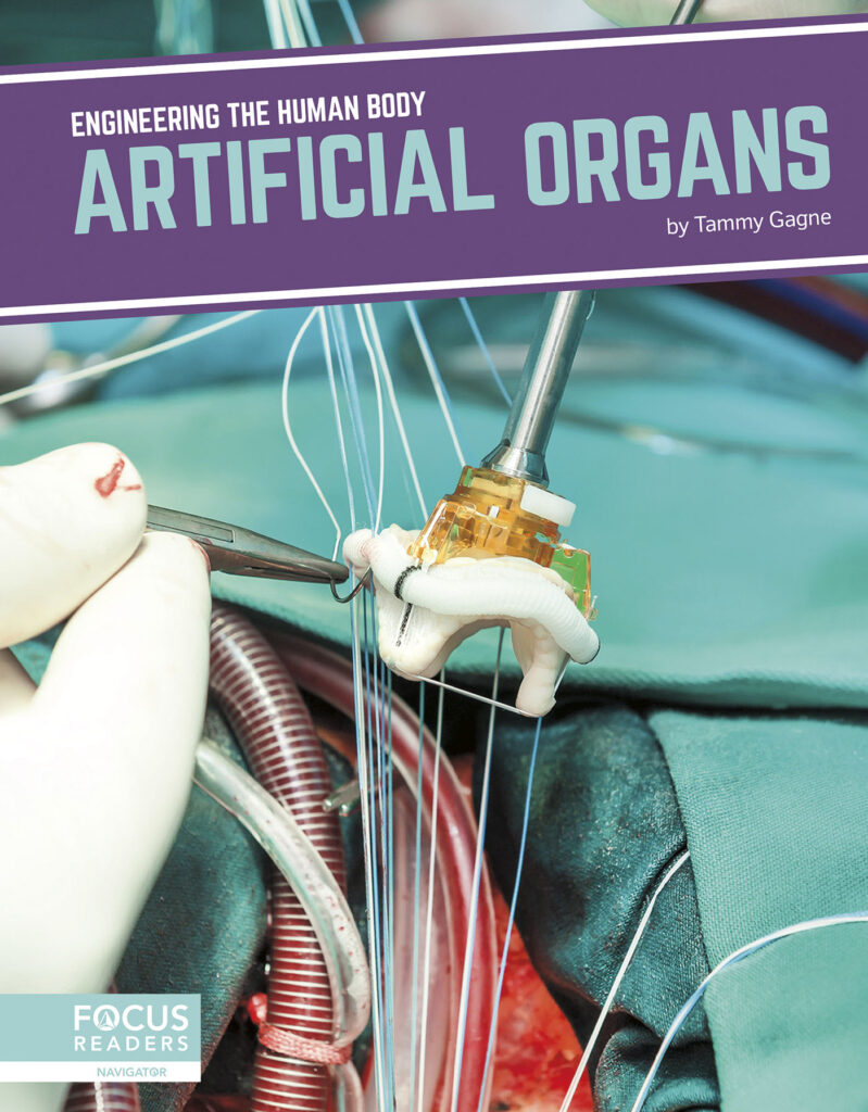 Introduces readers to the science behind artificial organs, including how and why the technology was created, current examples of the technology in action, and cutting-edge research advancing the technology. Eye-catching infographics, clear text, informative sidebars, and a “How It Works” special feature make this book an engaging introduction to this exciting technology. Preview this book.